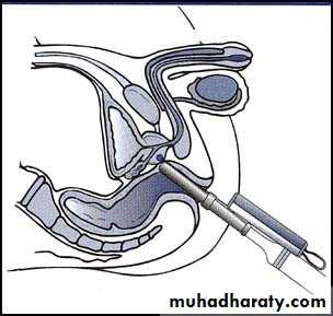 Male Reproductive System