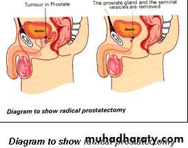 Male Reproductive System