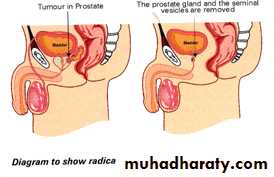Male Reproductive System