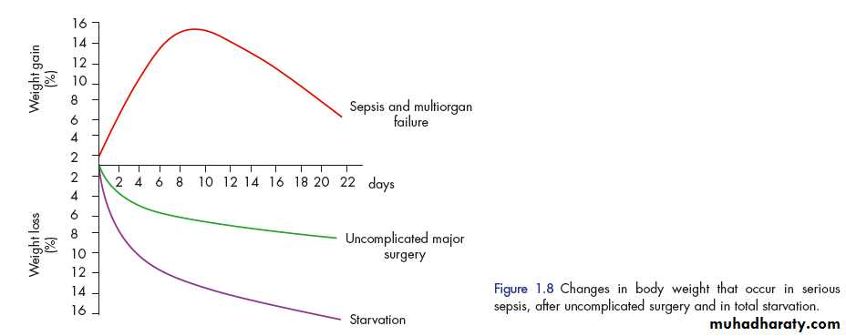 Metabolic Response to Trauma