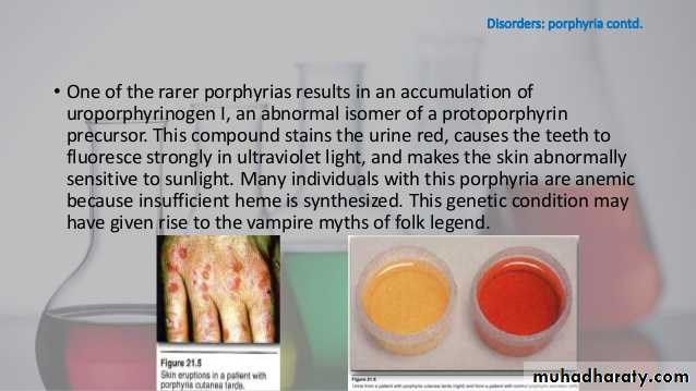 porphrins bile pigments