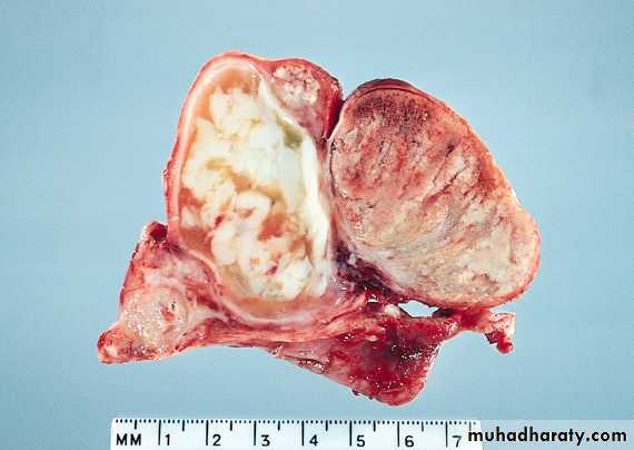 Male Reproductive System