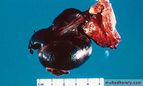 Male Reproductive System
