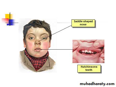 Spirochetes