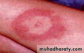 Spirochetes