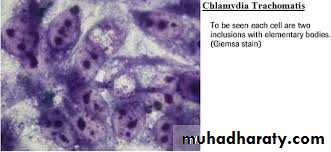 Clamydia and Mycoplasm