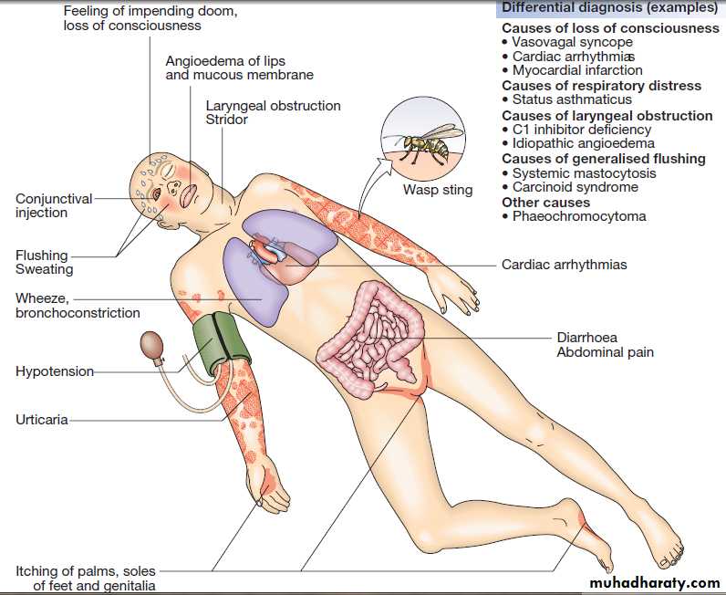 Immunological factors in disease