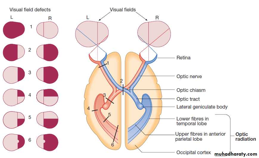 Neurological disease