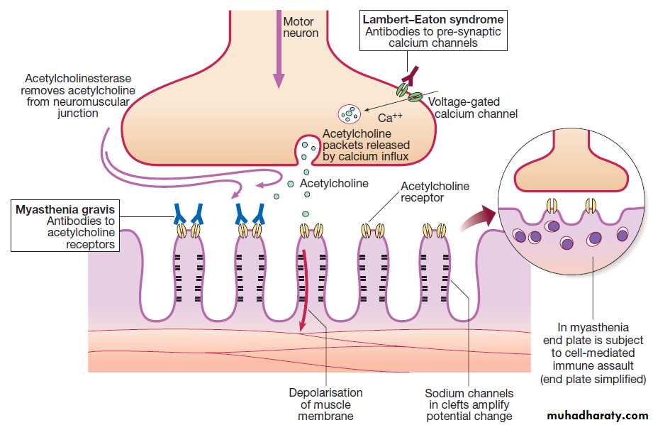 Neurological disease