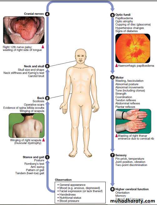 Neurological disease