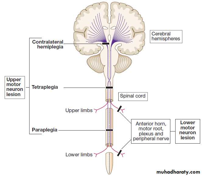 Neurological disease