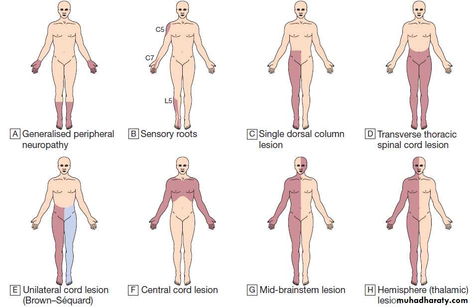 Neurological disease