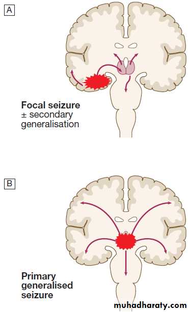 Neurological disease