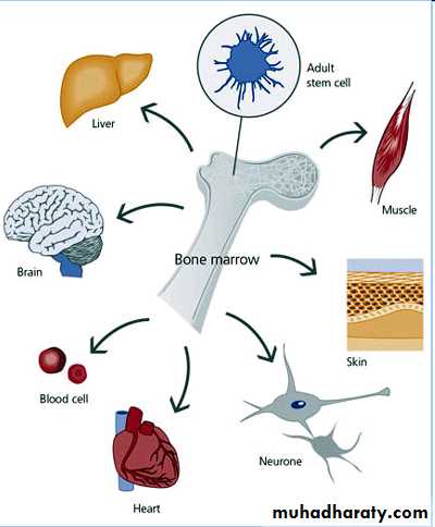 HSCT