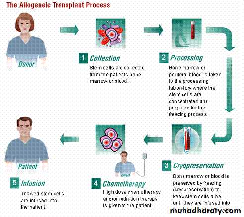 HSCT
