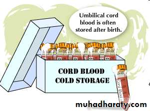 HSCT