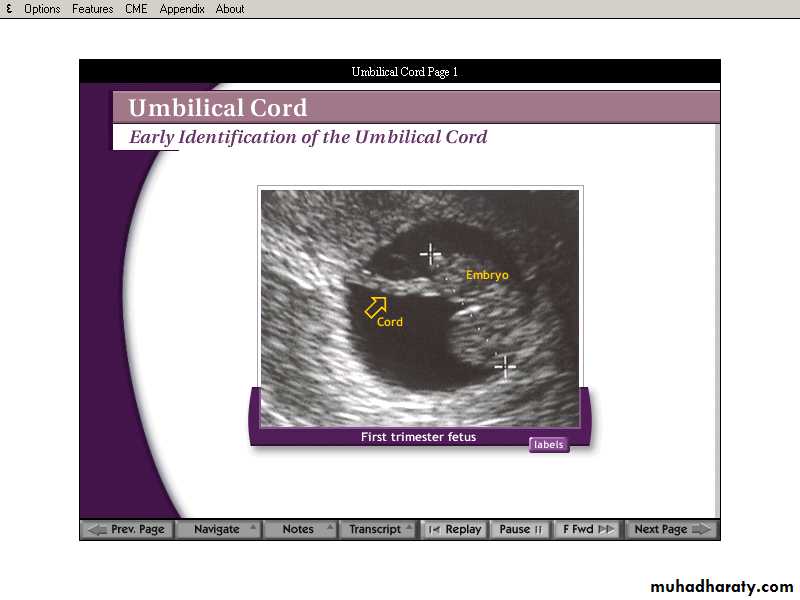 lec9 Fetus and Placenta I