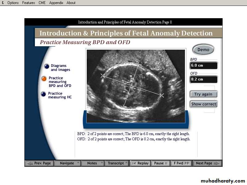 lec9 Fetus and Placenta I