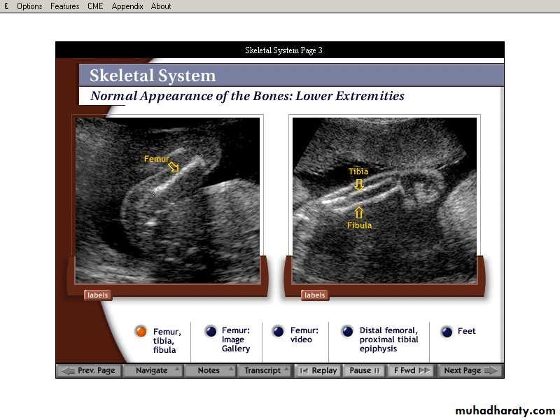 lec9 Fetus and Placenta I