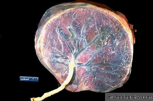 lec10 Development of the placenta
