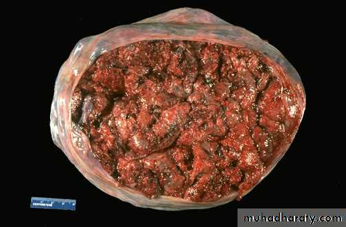 lec10 Development of the placenta