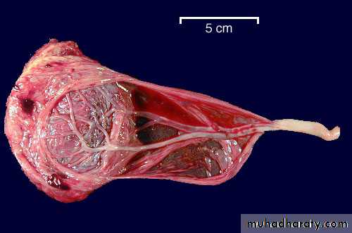 lec10 Development of the placenta