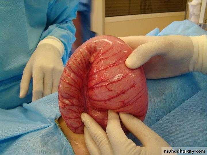 Pediatric surgery 2