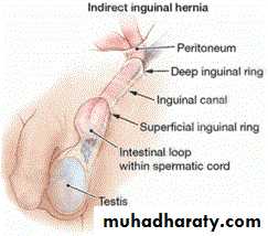Pediatric surgery 2
