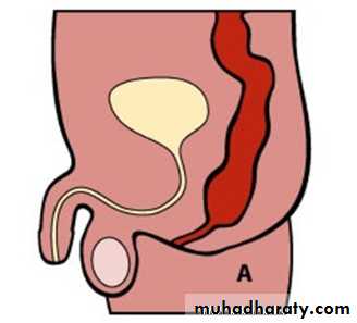 Pediatric surgery 2