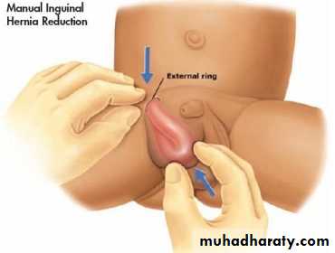 Pediatric surgery 2