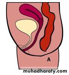 Pediatric surgery 2