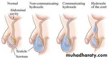 Pediatric surgery 2