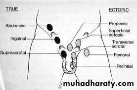 Pediatric surgery 2