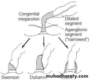 Pediatric surgery 2