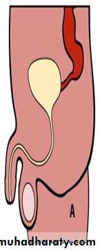 Pediatric surgery 2