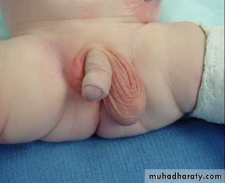 Pediatric surgery 2