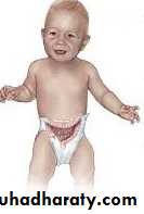 Pediatric surgery 2