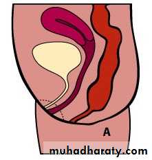 Pediatric surgery 2