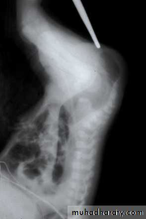 Pediatric surgery 2