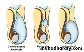 Pediatric surgery 2