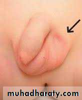 Pediatric surgery 2