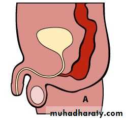 Pediatric surgery 2