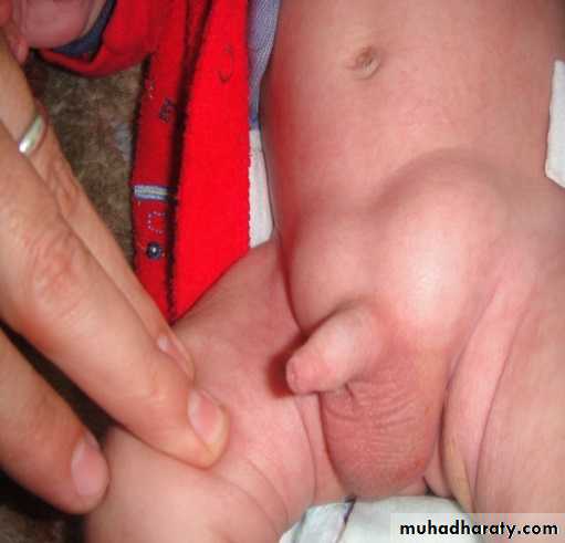 Pediatric surgery 2