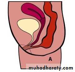 Pediatric surgery 2