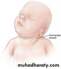 pediatric-surgery-3-neck-mass