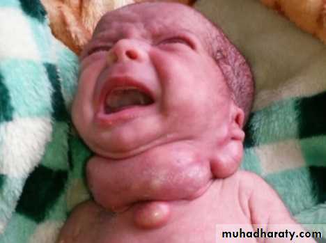 pediatric-surgery-3-neck-mass