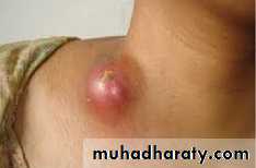 pediatric-surgery-3-neck-mass