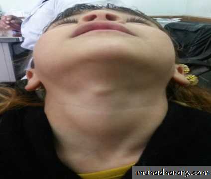pediatric-surgery-3-neck-mass