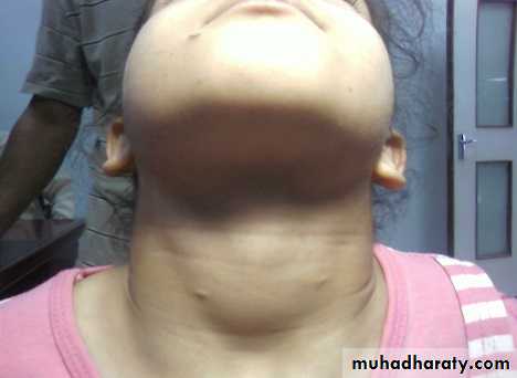 pediatric-surgery-3-neck-mass