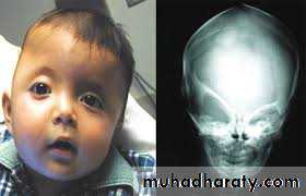 pediatric-surgery-3-neck-mass